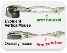 Evoluent VerticalMouse 4 Small - Vertical mouse